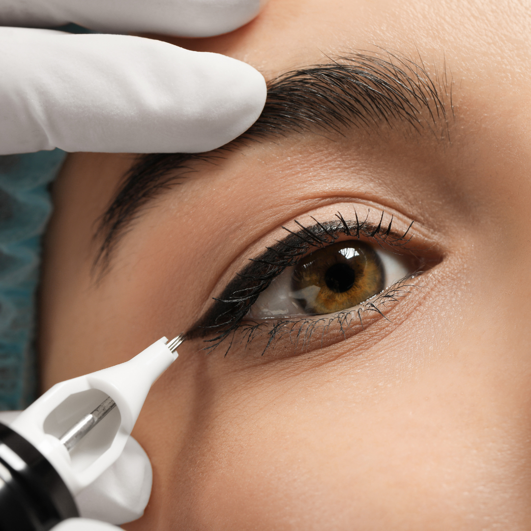 Dauerhafte Haarentfernung in Wiesbaden